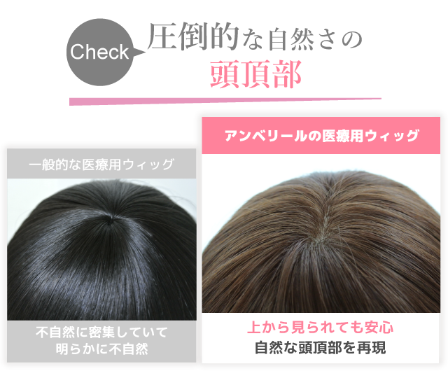 医療用ウィッグ 女性用かつらの通販とレンタルがおすすめのアンベリール